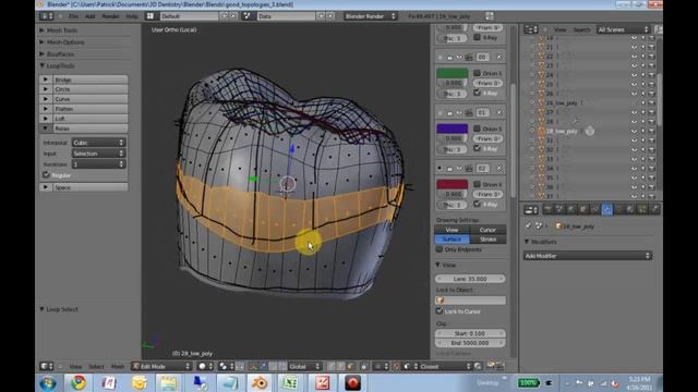 Topology of 3rd Molar смотреть онлайн