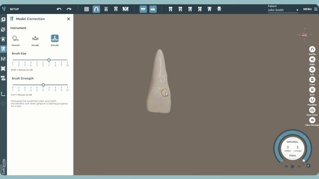 Teeth Sculpting Tool for Dental 3D Modeling Software смотреть онлайн