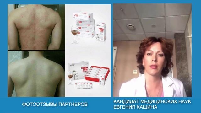 Мнение врача о Хемохим, кандидата медицинских наук смотреть онлайн