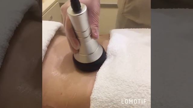 КАВИТАЦИЯ смотреть онлайн
