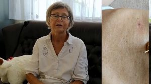 Как поставить банки на живот