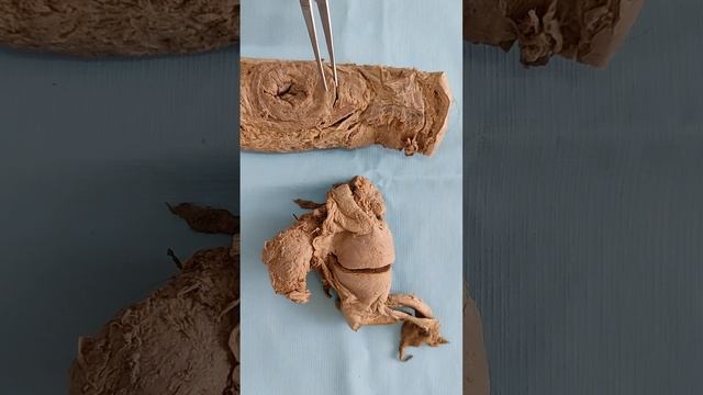 Женские половые органы. Промежность смотреть онлайн