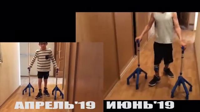 Эволюция ходьбы. Лешкины новые ортезы. смотреть онлайн