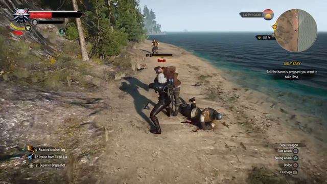 The Witcher 3: Wild Hunt_fire lit amputation смотреть онлайн