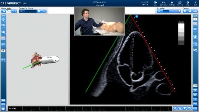 How to perform a full, comprehensive transthoracic echo study смотреть онлайн