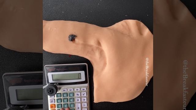 Playdough Surgery ??- Melanoma Wide Local Excision + Sentinel Lymph Node Biopsy смотреть онлайн