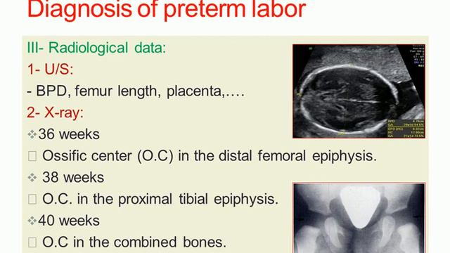 Preterm labor смотреть онлайн