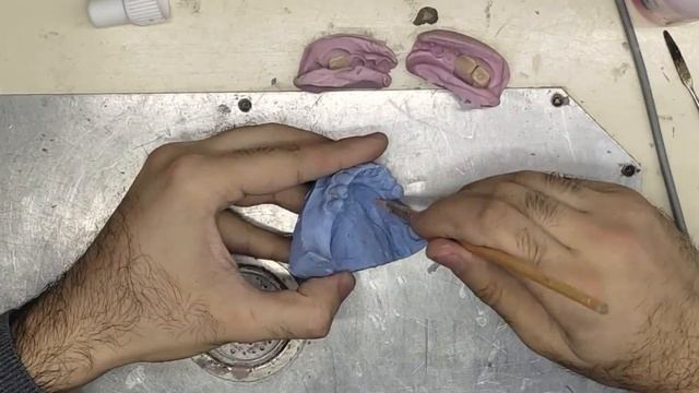 Ацеталовый Протез с Силиконовым Замком смотреть онлайн