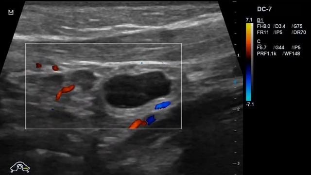 Киста но чего? смотреть онлайн