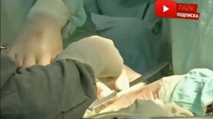 Живот девушки начал расти после родов. разрезав его, врачи схватили камеру ...