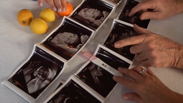 КАК ВЫБРАТЬ ПОЛ РЕБЕНКА | Как запланировать пол ребенка смотреть онлайн