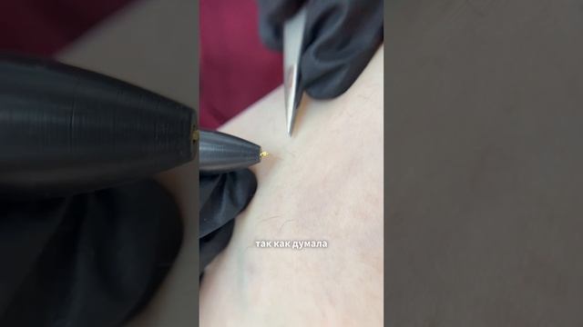 Электроэпиляция решит те проблемы, с которыми не справляются другие виды эпиляции #эпиляциямосква смотреть онлайн