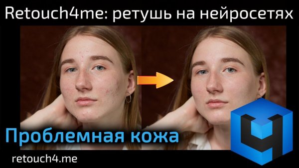 Retouch4me Heal: ретушь на нейросетях. Проблемная кожа