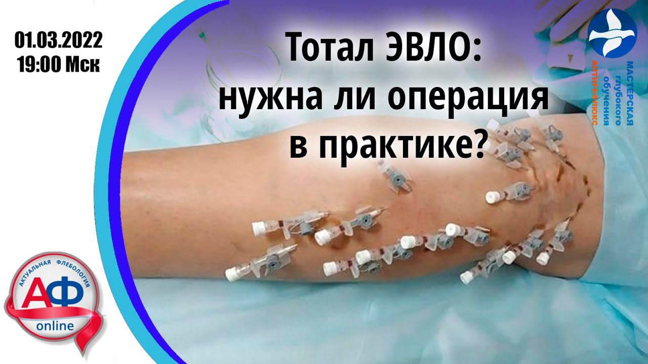 Тотал ЭВЛО: нужна ли операция в практике? 01.03.22 смотреть онлайн