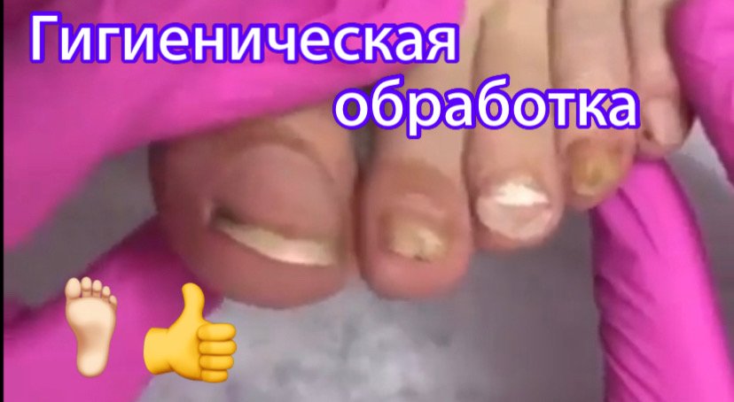 Гигиеническая обработка ???? смотреть онлайн