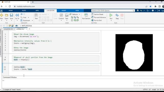 Brain Tumor detection and removing Skull using roipoly || MATLAB || Medical Image Processing смотреть онлайн