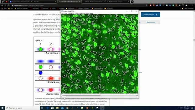 ImageJ/FIJI plugin: Semi-automatic cell-by-cell object-based colocalization analysis - PART 1 смотреть онлайн