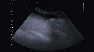 3D узи ребенка животе у матери 3D ultrasound baby belly mother