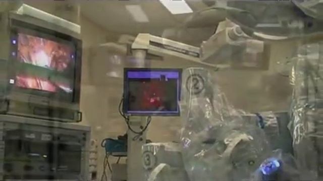Intraoperative Laparoscopic Fluorescence Guidance To Sentinel Lymph Node In Prostate Cancer Patient смотреть онлайн