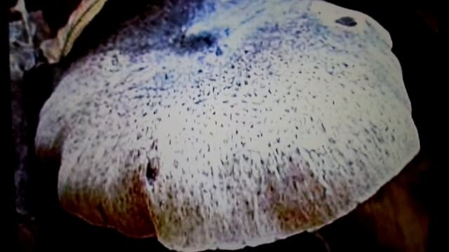 Champignons Veneneux פיטריות רעלים