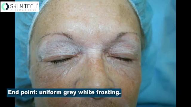 Easy Phen Light and Lip & Eyelid - Deep Peeling (Skin Tech) смотреть онлайн