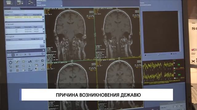 Причина возникновения дежавю