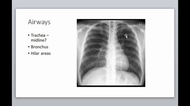 Basic Chest X-ray reading principles New Ethiopian Medical lecture በአማርኛ смотреть онлайн
