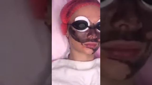 Карбоновый пилинг в ЦНК Альбины Самойловой смотреть онлайн