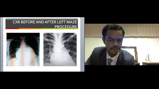 Fekede D Agwar | Cardiology Webinar 2021 | April 14-15, 2021 | Speaker смотреть онлайн