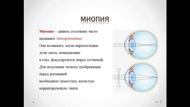 Физика, 8 класс: Глаз как оптическая система. Дефекты зрения смотреть онлайн
