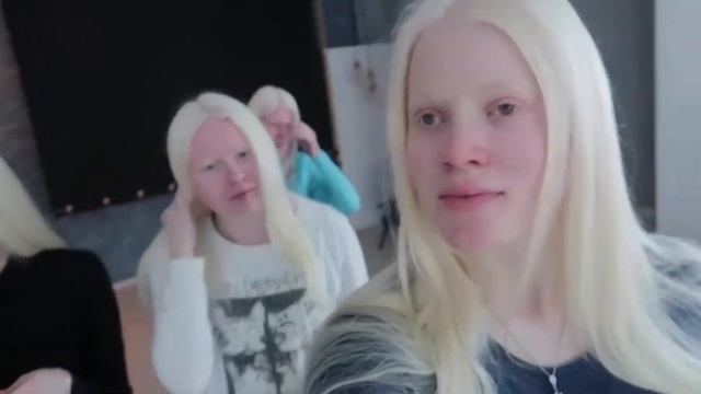 Факты об альбинизме смотреть онлайн