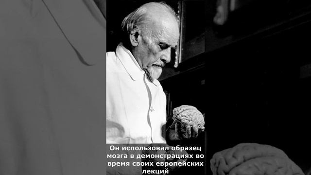 Что случилось с мозгом Ленина после смерти? смотреть онлайн