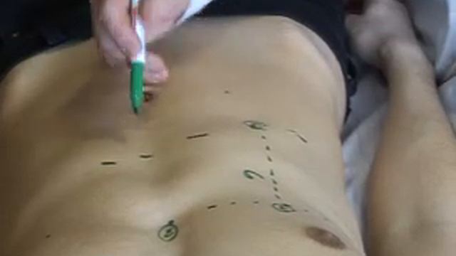 Percussion of liver by Kurlow method смотреть онлайн