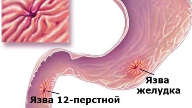 ЧТО БУДЕТ ЕСЛИ ДЕВУШКА ВЫПЬЕТ ВИАГРУ??? смотреть онлайн