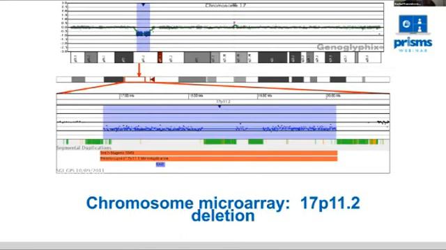 Understanding The Genetics Of Smith-Magenis Syndrome