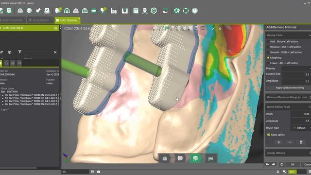 DWOS - Create a Partial Combined Superstructure on a Milled Bar смотреть онлайн
