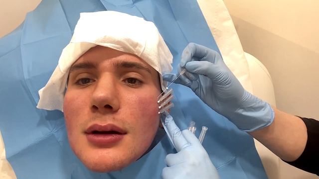 I got a Bella Hadid Face Thread Lift with 60 Threads!? || Fox Eyes Brow Lift смотреть онлайн