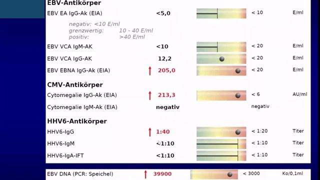Dr Bieger Postinfektiöse Fatigue nach SARS CoV 2 Infektion trotz Dreifach Impfung смотреть онлайн