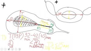 Введение в УЗИ малого таза у женщин  Часть 2. 2022 04 26 14 41 49