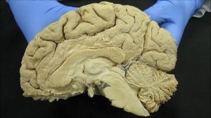 Конечный мозг