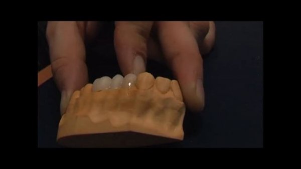 DMG - Luxatemp (Video 2)