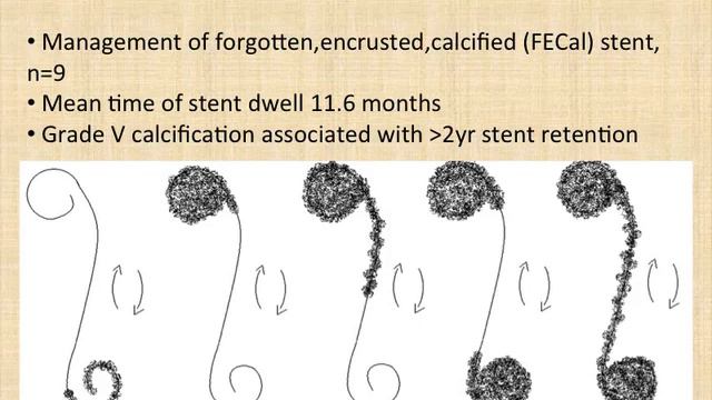 Ureteral Stents: Complications and Innovations смотреть онлайн
