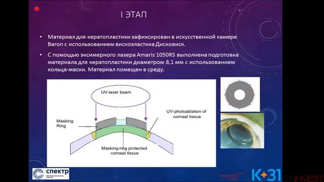 Эксимерлазерная хирургия роговицы SCHWIND: современные решения известных проблем смотреть онлайн