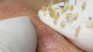 Enjoy Every Day With The Best Video Loan Nguyen Spa Official  2314