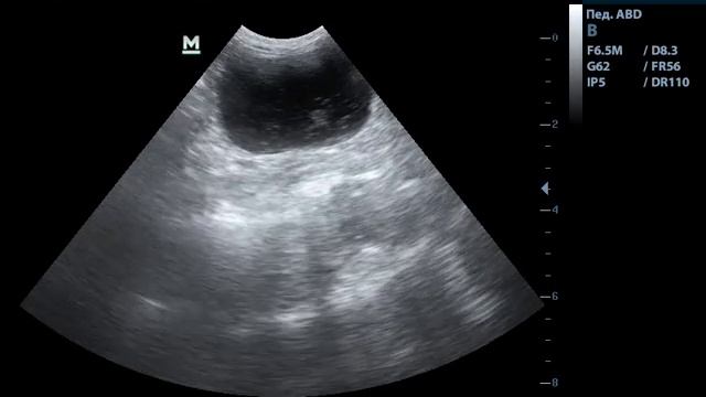 Мелкодисперсный гиперэхогенный осадок в мочевом пузыре кота смотреть онлайн