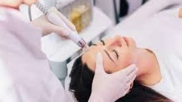 Best Microneedling in The Lancasters