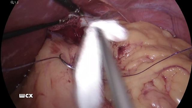 Слив что делать? смотреть онлайн