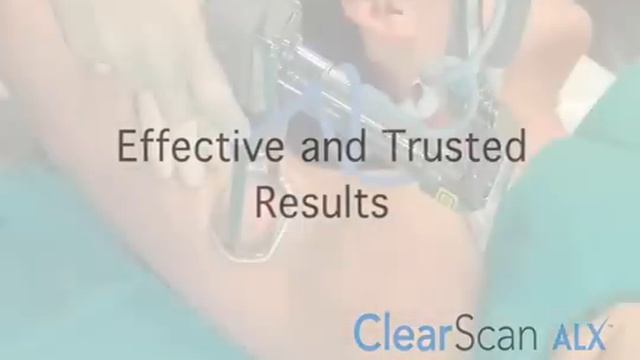Лазерная Эпиляция александритовым лазером ClearScan ALX смотреть онлайн
