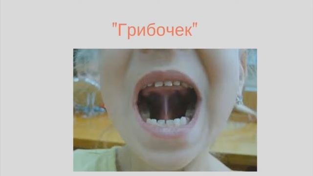 Как избавиться от картавости? Как исправить картавость в домашних условиях? Как убрать картавость? смотреть онлайн