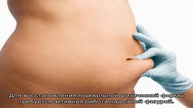 Как убрать живот после родов смотреть онлайн